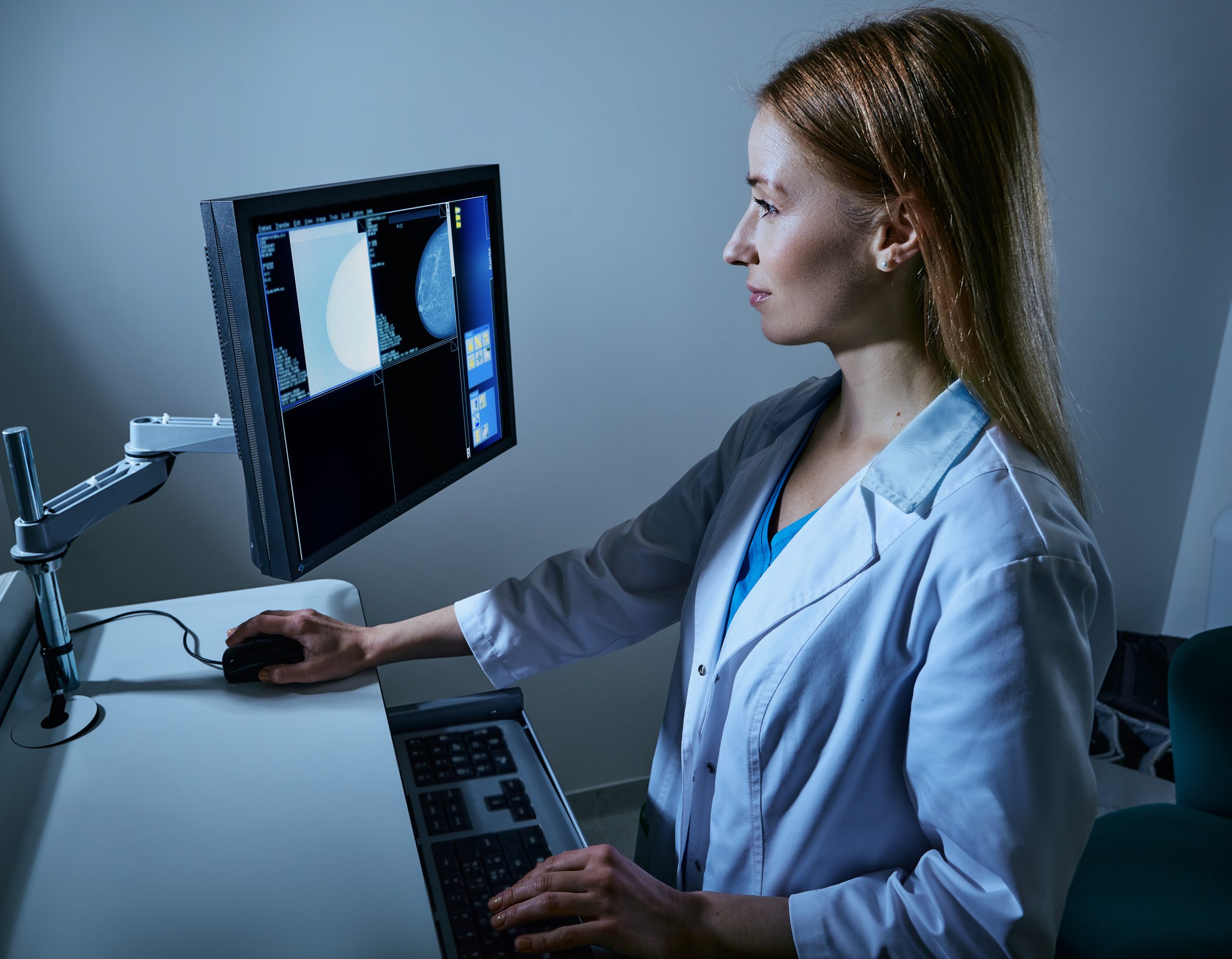 Tampa mammogram screening diagnostic results